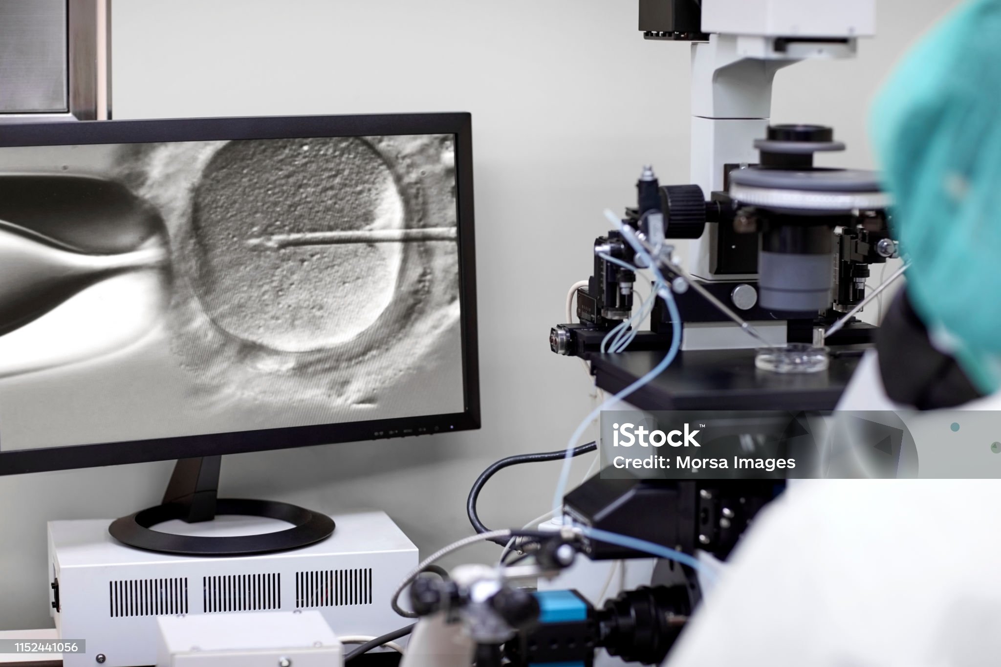 Fertilización In Vitro FIV en Puebla – Fertility Center Hospital Ángeles